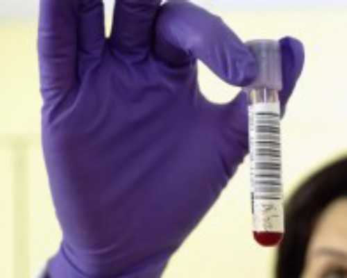 盆腔炎：揭秘症状背的真相