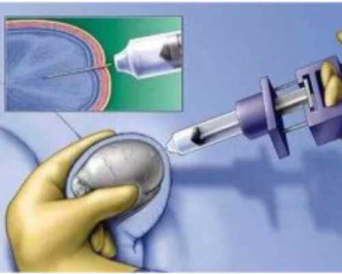 国内供卵试管生孩子_国内供卵过程,贵州安顺有没有做试管婴儿的医院？答案全