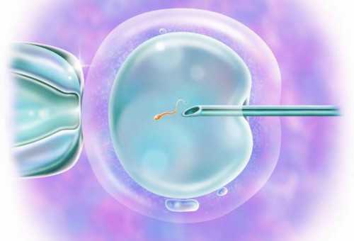 贵阳包生男孩合同，贵阳试管婴儿费用