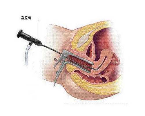 中国爱心助孕网_有专业供卵代孕机构吗,移植优质胚胎成功率高吗？