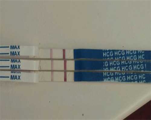 贵阳卵巢切除还能做试管婴儿吗，贵阳试管婴儿费用