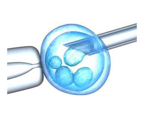 霉菌性阴道炎的预防攻略：五个日常习惯让你远离感染